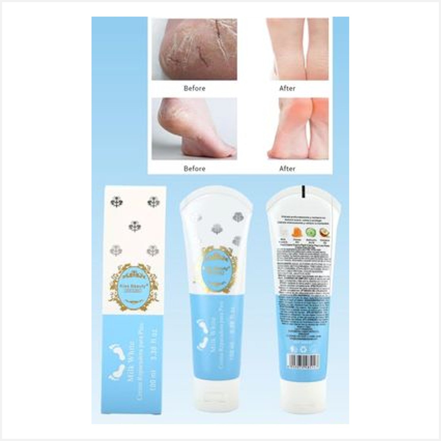 Kiss Beauty Crema Reparadora de pies Milk White